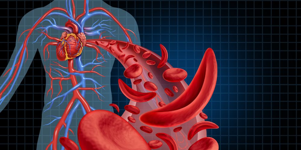 causas y sintomas de la anemia