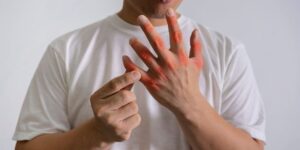 hombre con dolor en las manos por exceso de acido urico