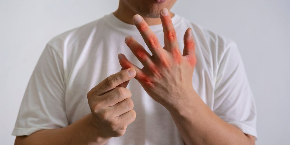 hombre con dolor en las manos por exceso de acido urico